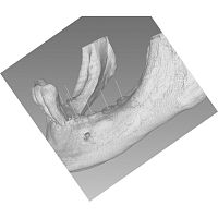 Medical software BTI Scan 4dentalsurgeryvisualization
