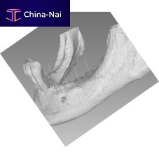 Medical software BTI Scan 4dentalsurgeryvisualization