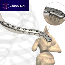 Clavicle compression plate AS.SH.029distallockingnon-locking
