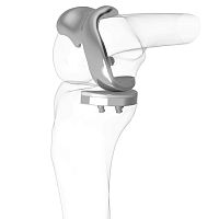 Unicondylar knee prosthesis iDuo® fixed-bearingcemented