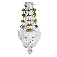 Minimally invasive pedicle screw positioning system CREO MIS®
