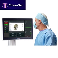 Orthopedic surgery surgical navigation system VELYSoptical