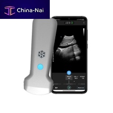 Hand-held ultrasound system H35Cfor abdominal and pelvic ultrasound imagingfor emergency medicine ultrasound imagingfor urology ultrasound imaging