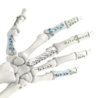 Hand phalange compression plate metacarpal jointlockingtitanium
