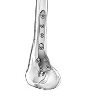 Femoral osteotomy plate distallockingtitanium