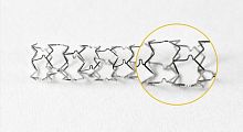 Coronary stent SEQUENCEmetaldrug eluting