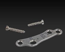 Metatarsophalangeal joint arthrodesis plate NeoFit®metallic