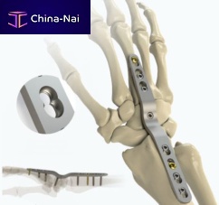 Carpal joint arthrodesis plate 1022-0008lockingmetallic