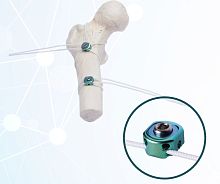Metallic multifilament bone cerclage wiring EXN1714
