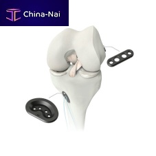 Anterior cruciate ligament ligament prosthesis M-ARSsynthetic
