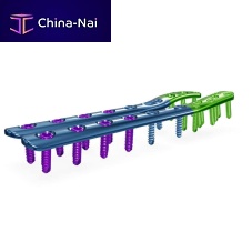 Fibula compression plate 26.06.20 seriesdistallockingtitanium