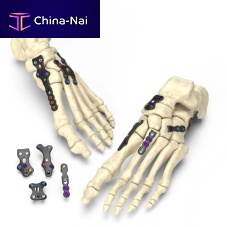 Hindfoot arthrodesis plate Stratum®forefootlocking