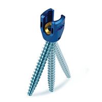 Lumbar-sacral vertebra pedicle screw REVERE® Uniplanarpolyaxialmetallic