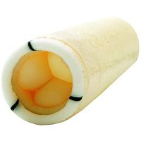 Ascending aorta vascular bioprosthesis SMOOTH 300xenograftwith valve