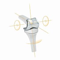 Interphalangeal hand joint implant PIPR