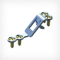 Vertebra laminoplasty plate Z-Rhythm lockingmetallic