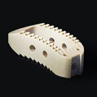 Lumbar interbody fusion cage SYNSTER® TLIFtransforaminalPEEK