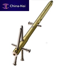 Ankle intramedullary nail VALORdistal fixation