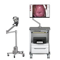 Video colposcope YKD-3001trolley-mounted