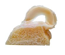 Allograft meniscus implant FlexiGRAFT®