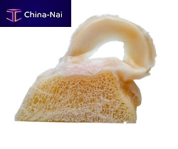 Allograft meniscus implant FlexiGRAFT®