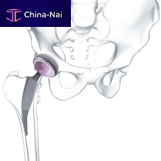 Minimally invasive hip prosthesis Metha® cementless