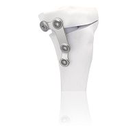 Tibia osteotomy plate TBFIXstainless steel