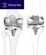 Total knee prosthesis iTotal® CRsliding, cruciate-retainingcemented