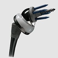 Reverse shoulder prosthesis Comprehensive ®cementless