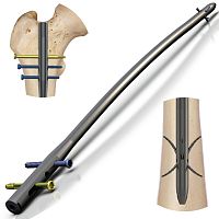 Femoral intramedullary nail Navy A/Rproximal fixationdistal fixation