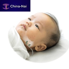 Mandibular distractor internalpediatric