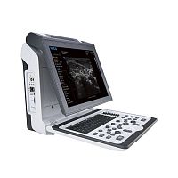 Portable ultrasound system Apogee 2300for urology ultrasound imagingB/Wcolor doppler