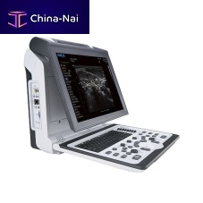 Portable ultrasound system Apogee 2300for urology ultrasound imagingB/Wcolor doppler