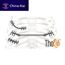 Rib compression plate ThoRib®titaniumpediatric