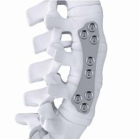Lumbar arthrodesis plate ARTHEMISthoraco-lumbaranterolateraltitanium