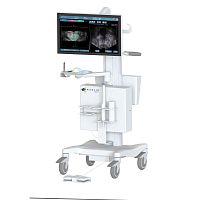 On-platform ultrasound system Trinity®for urology ultrasound imaging3D/4Dneedle guidance