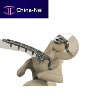 Clavicle compression plate AS.SH.031distallockingnon-locking
