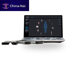 Portable ultrasound system SonoAir 60for cardiovascular ultrasound imagingfor multipurpose ultrasound imagingfor gynecological and obstetric ultrasound imaging