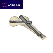 Femoral intramedullary nail Gamma3trochanterproximal fixationtitanium