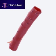 Pulmonary artery vascular bioprosthesis CryoGraft® allograftwith valve