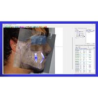 Medical software Delta-Dentdentalanalysis3D viewing