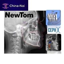 Dental imaging software CephX diagnosticcephalometric analysisvalidation