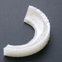 Xenograft meniscus implant FibroFix
