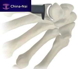 Metacarpophalangeal joint implant STABLYX ®