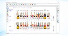Dental software FP32 image analysisrecordingeducation