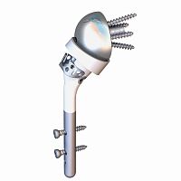 Reverse humeral stem HUMELOCK II®cementless