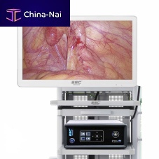 ENT endoscopy column laparoscopic surgeryurologic endoscopic surgery