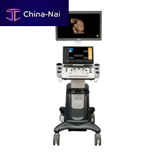 On-platform ultrasound system A30for multipurpose ultrasound imagingfor gynecological and obstetric ultrasound imagingfor cardiovascular ultrasound imaging