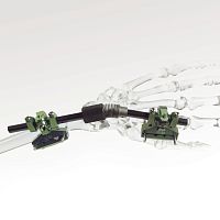 Radius external fixation system FIXUS33 wristhumeruscalcaneus