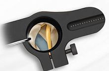 Spinal retractor SOARorthopedic surgeryneurosurgery